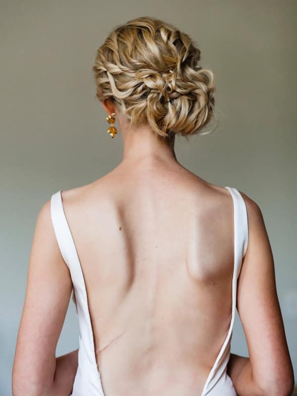On Curves and Chronic Pain | My Scoliosis Story